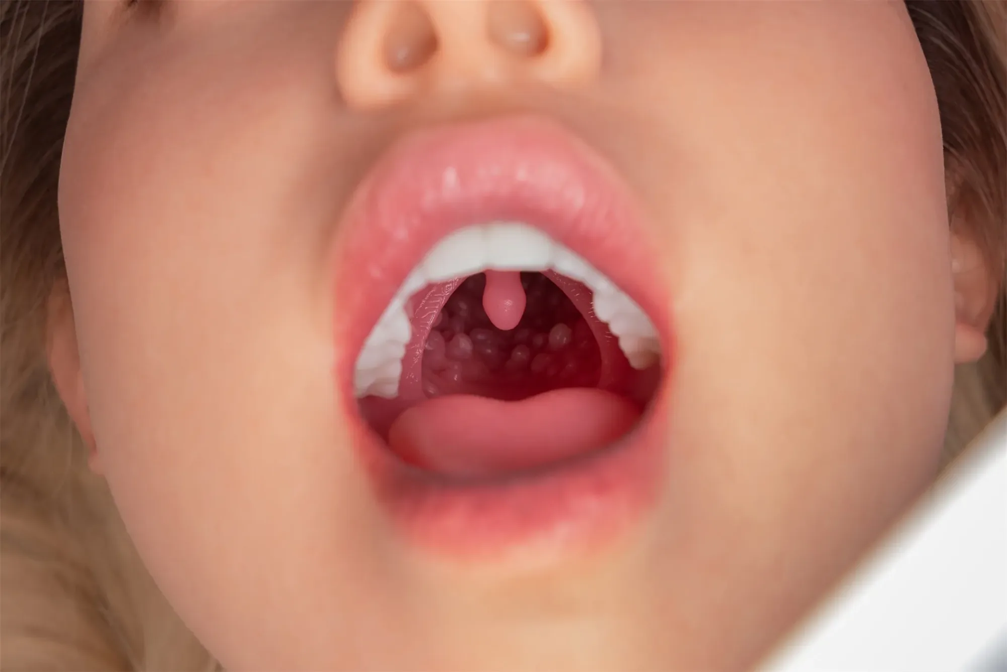 FANREAL Doll丨ROS Head and Hard Silicone Head (Extra Doll Heads) view 6